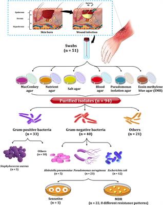 Enhanced Efficacy of Some Antibiotics in Presence of Silver Nanoparticles Against Multidrug Resistant Pseudomonas aeruginosa Recovered From Burn Wound Infections